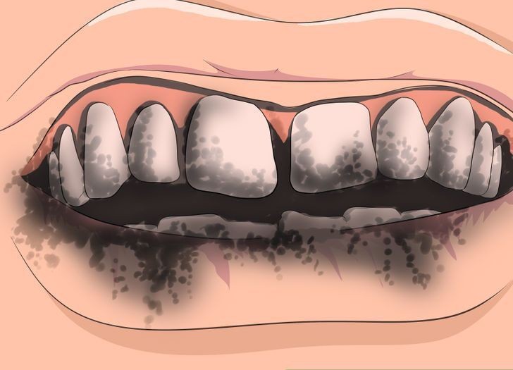 teeth problem treatment abu dhabi
